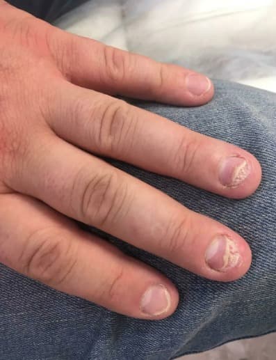 Eczemaron समीक्षा