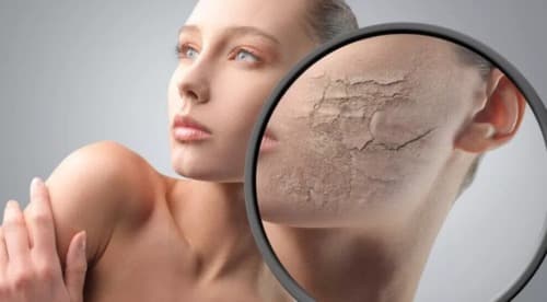 Eczemaron कीमत